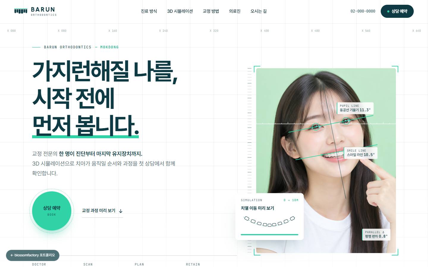 바른이치과 홈페이지 PC 첫 화면, '가지런해질 나를, 시작 전에 먼저 봅니다.' 제목과 측정선이 그려진 인물 사진, 민트색 원형 상담 예약 버튼