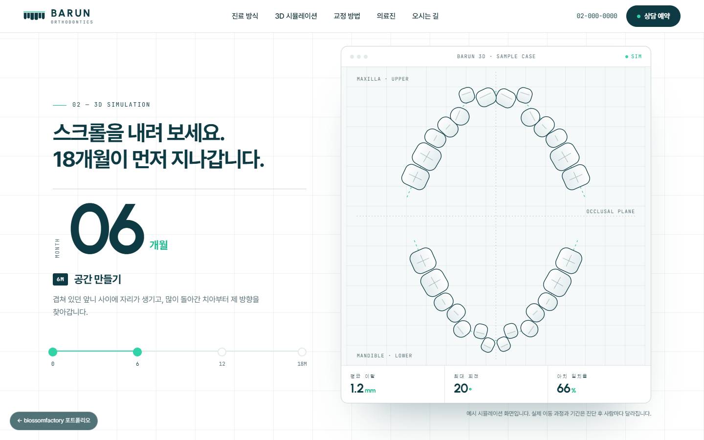'스크롤을 내려 보세요. 18개월이 먼저 지나갑니다.' 제목 아래 06개월 공간 만들기 단계와 오른쪽 위아래 치열 시뮬레이션, 평균 이탈 1.2mm·아치 일치율 66% 수치