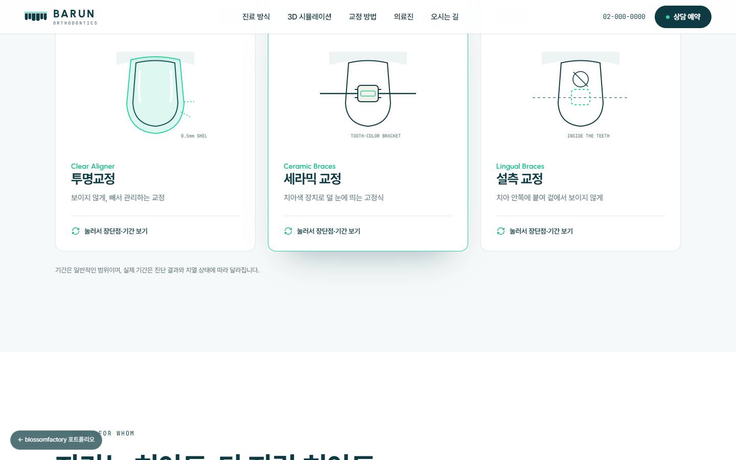 투명교정, 세라믹 교정, 설측 교정 세 장의 카드와 각 장치를 선으로 그린 그림, '눌러서 장단점·기간 보기' 안내