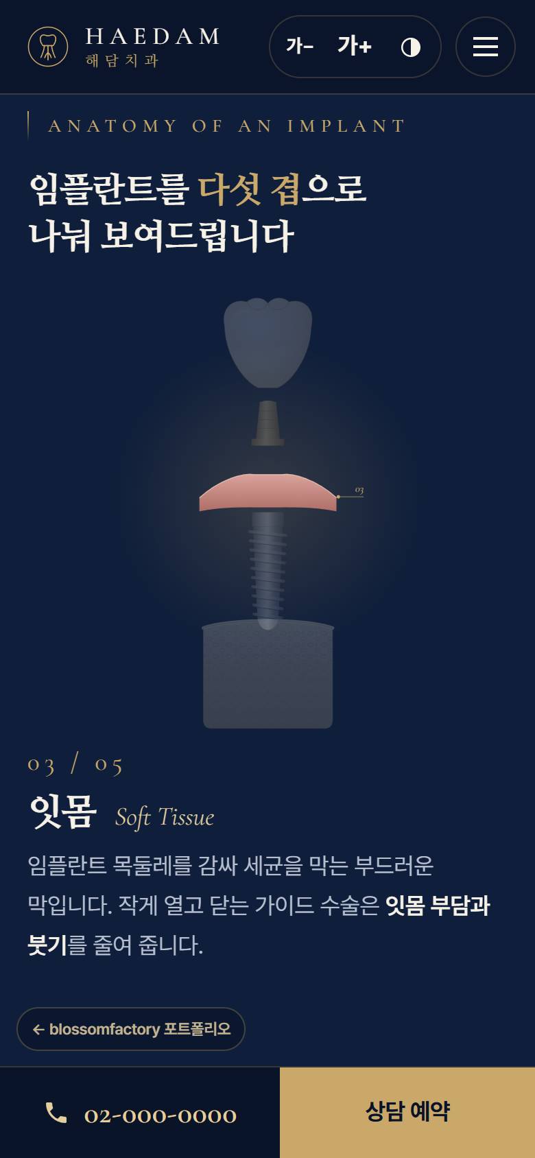 휴대폰 화면의 해담치과 첫 화면과 글자 크기 안내 말풍선, 잇몸 단계가 켜진 임플란트 분해도, '오늘은 상담만 받으셔도 괜찮습니다' 예약 섹션과 하단 고정 전화 바 2