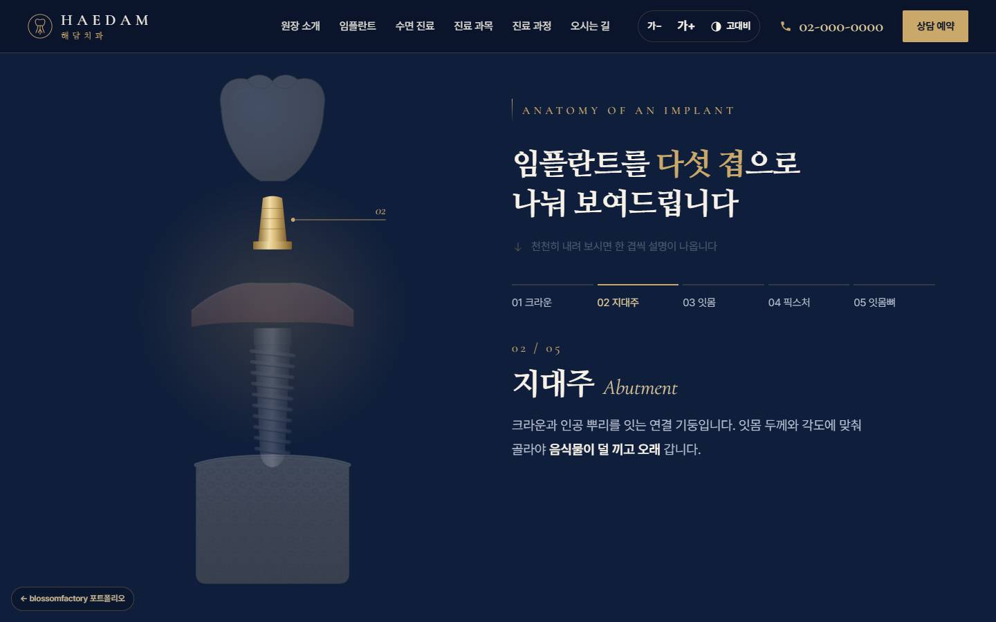네이비 배경의 '임플란트를 다섯 겹으로 나눠 보여드립니다' 섹션, 위아래로 벌어진 임플란트 그림에서 지대주만 밝게 켜지고 오른쪽에 02/05 지대주 Abutment 설명