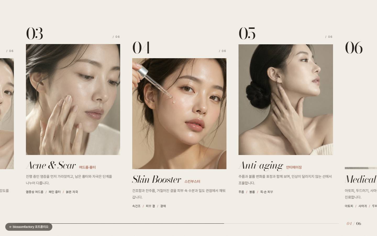 가로로 흘러가는 진료 분야 카드, 03 여드름 흉터, 04 스킨부스터, 05 안티에이징과 아래 진행 바