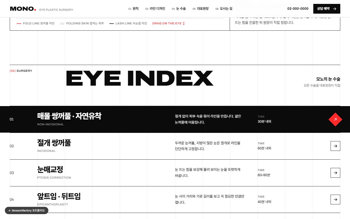 EYE INDEX 섹션, 검게 반전된 매몰 쌍꺼풀·자연유착 줄과 빨간 화살표, 그 아래 절개 쌍꺼풀, 눈매교정, 앞트임·뒤트임 목록과 수술 시간