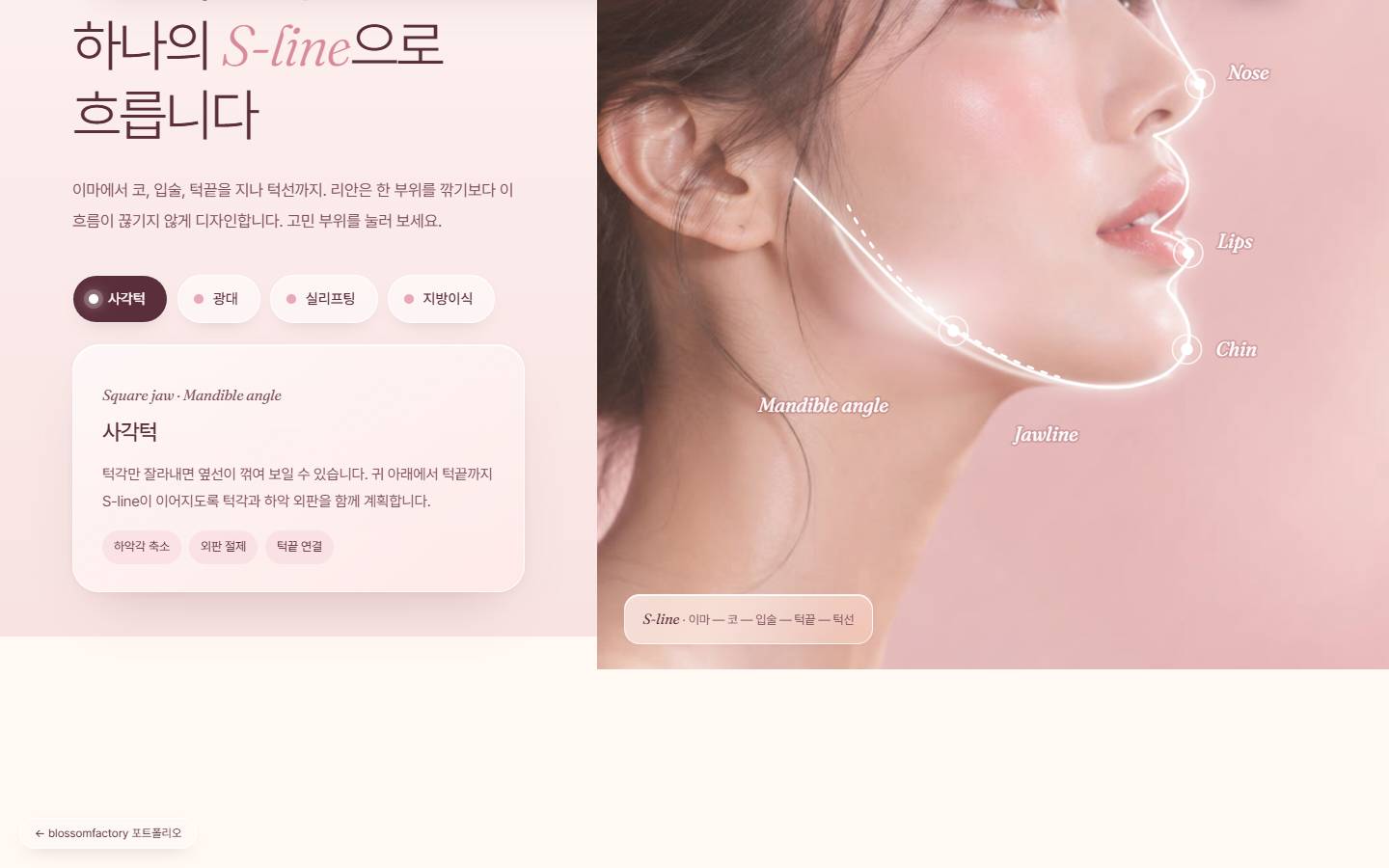 옆얼굴 사진 위에 이마부터 턱선까지 흰 S라인이 그려지고, 사각턱 버튼이 선택되어 턱각과 턱선 부위가 표시된 화면과 사각턱 설명 카드