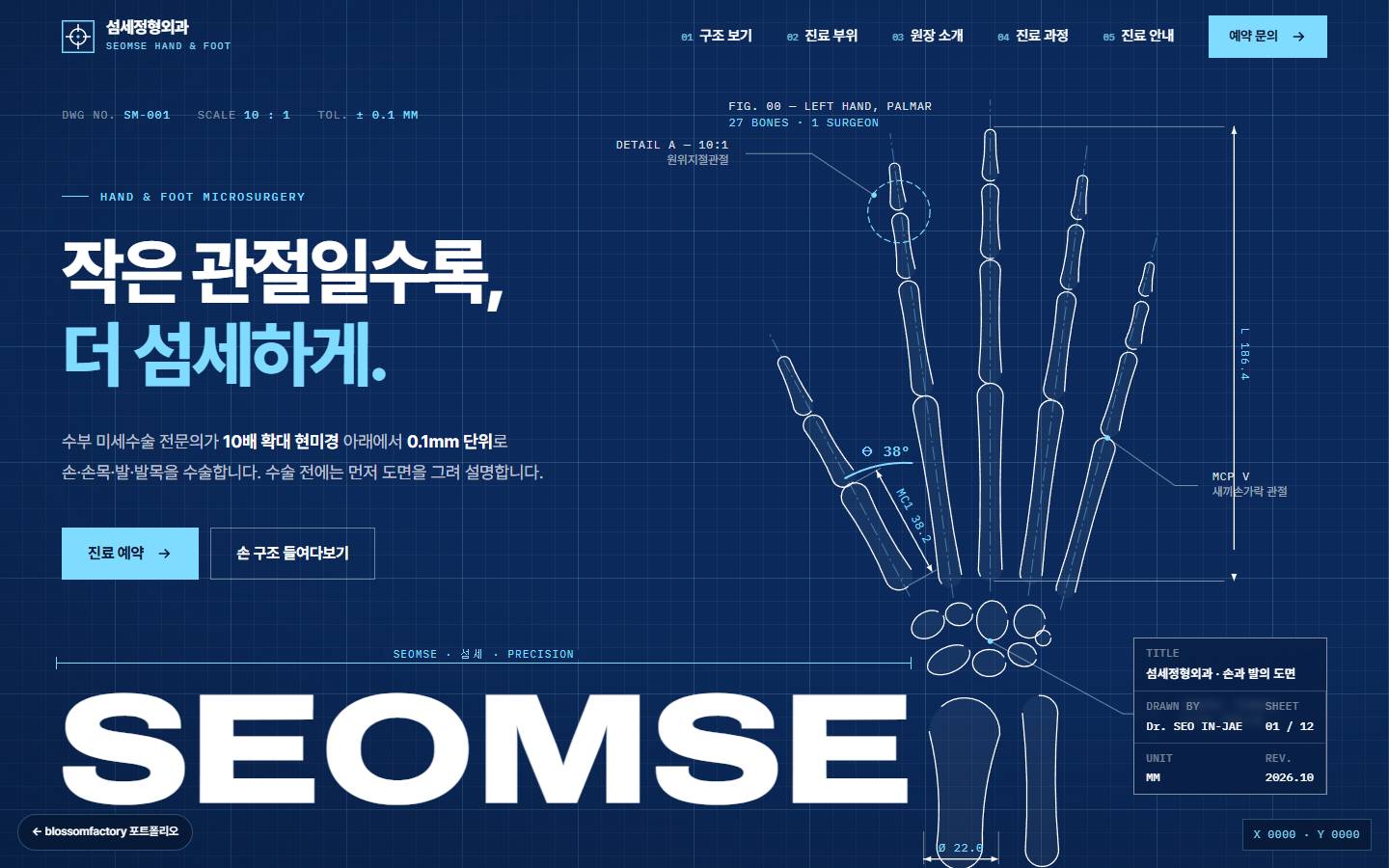 섬세정형외과 홈페이지 PC 첫 화면, 블루프린트 파란 바탕에 흰 선으로 그린 손 뼈 도면과 '작은 관절일수록, 더 섬세하게.' 제목, 하늘색 진료 예약 버튼과 큰 SEOMSE 워드마크
