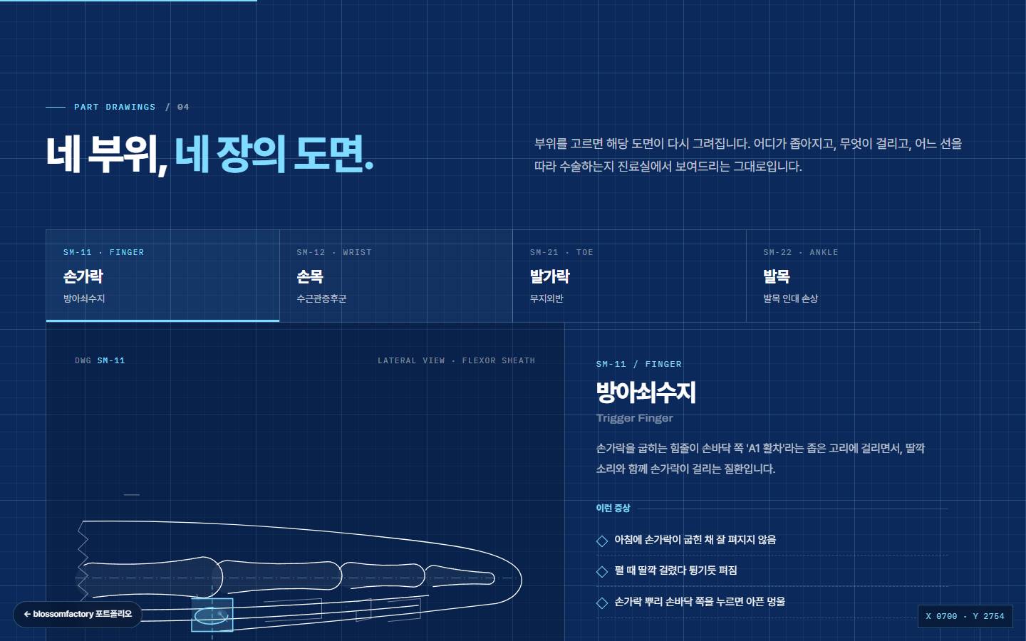 '네 부위, 네 장의 도면.' 섹션, 손가락·손목·발가락·발목 탭과 손가락 옆모습 기술 도면, 오른쪽 방아쇠수지 설명과 증상 목록